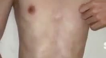 lokal bening
